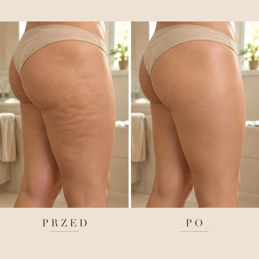 Przed i po: biodra i udo